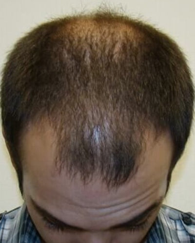 Before Volume & Thickness